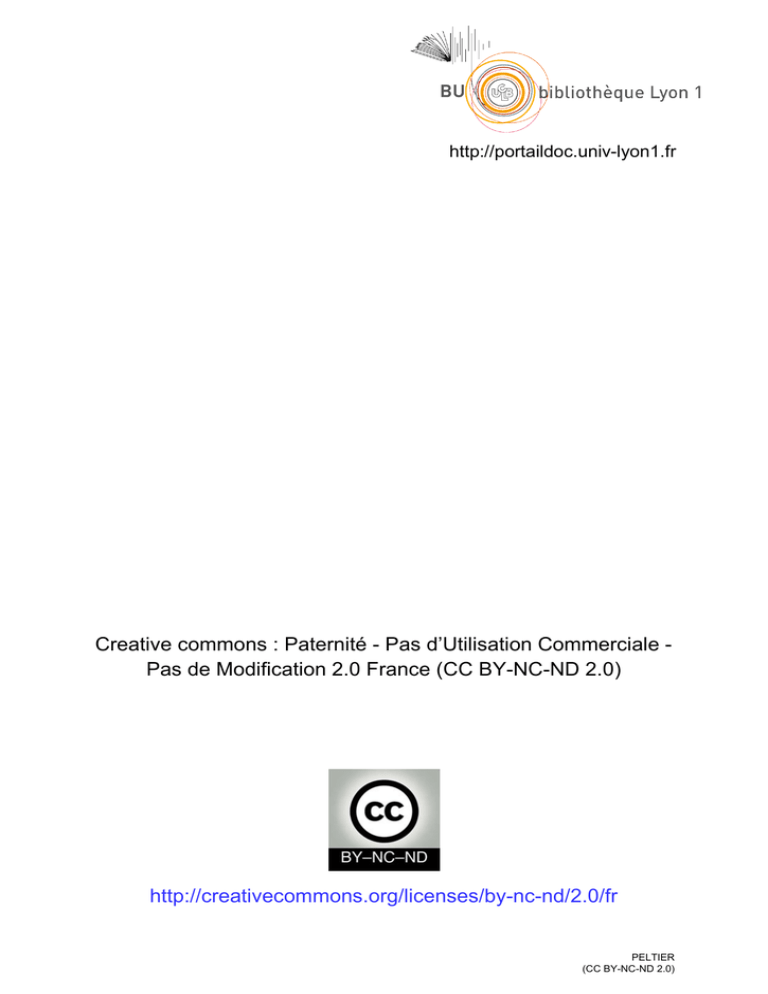 Hypersignal De La Corne Postérieure Du Ménisque Interne Grade 2
